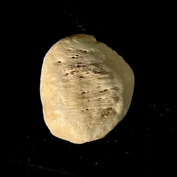Human Kneecap