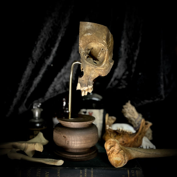 Partial human skull on stand