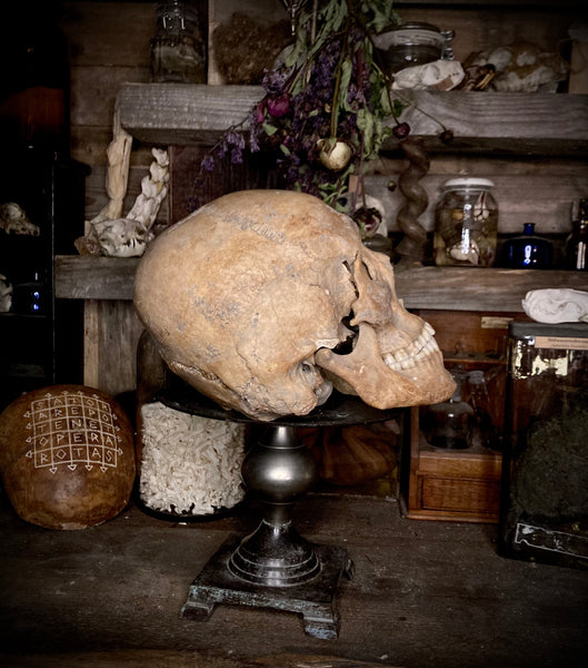 Peruvian elongated skull