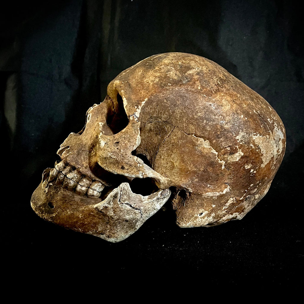 How to Read a Human Skull: A Friendly Guide to Sex &amp; Ancestry Clues