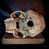 Item 11. Human skull