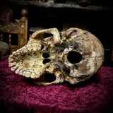Human skull