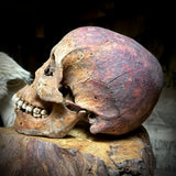 Human skull with mandible