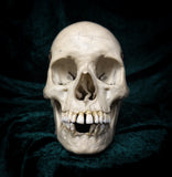 Medically prepared human skull