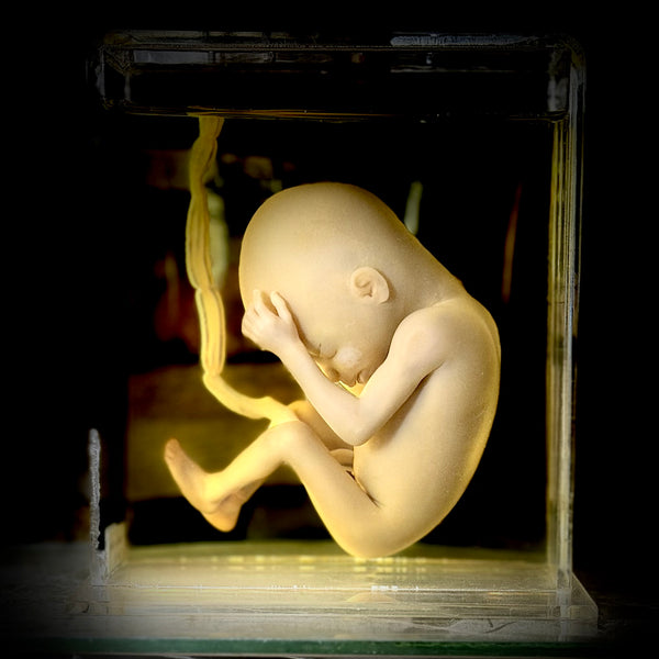 Foetal specimen