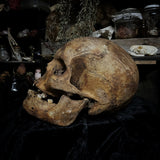 Human skull