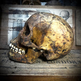 Human skull with mandible