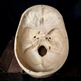 Item 5. Human medical skull