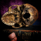 A human skull