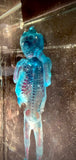 Item 1. Diaphonized human fetus