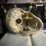 Medically prepared human skull