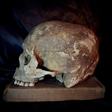 Item 11. Human skull
