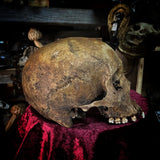 Human skull
