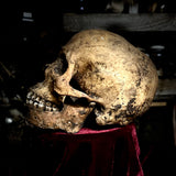 A human skull with mandible