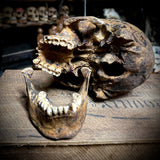 Human skull with mandible