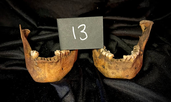 Item 13. Two human mandibles