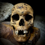 Human skull with mandible