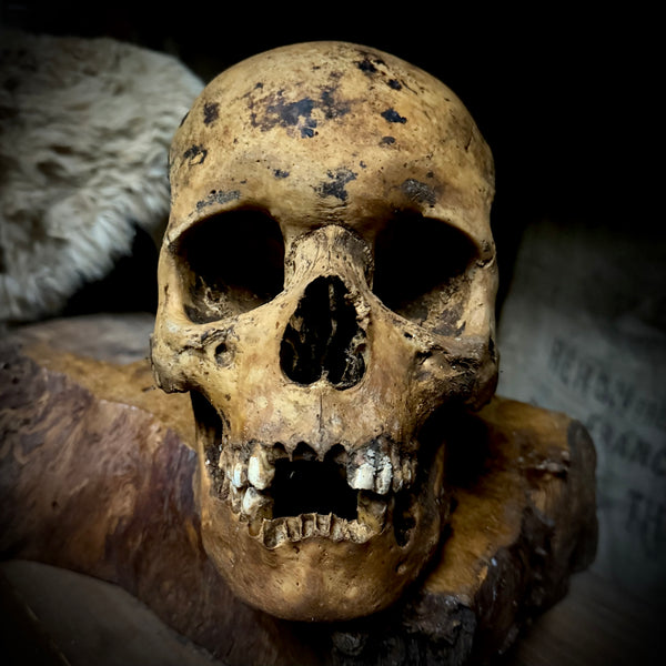 Human skull with mandible