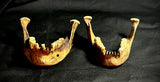 Item 10. Two human mandibles