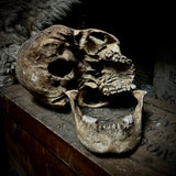 Human skull with mandible