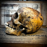 Human skull with mandible