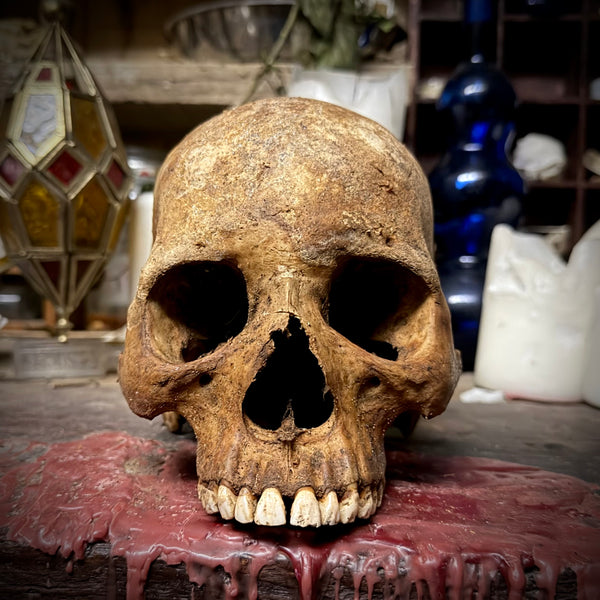 Human skull