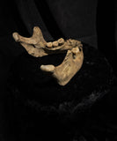 A mandible