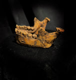 A mandible