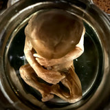 Fetal specimen