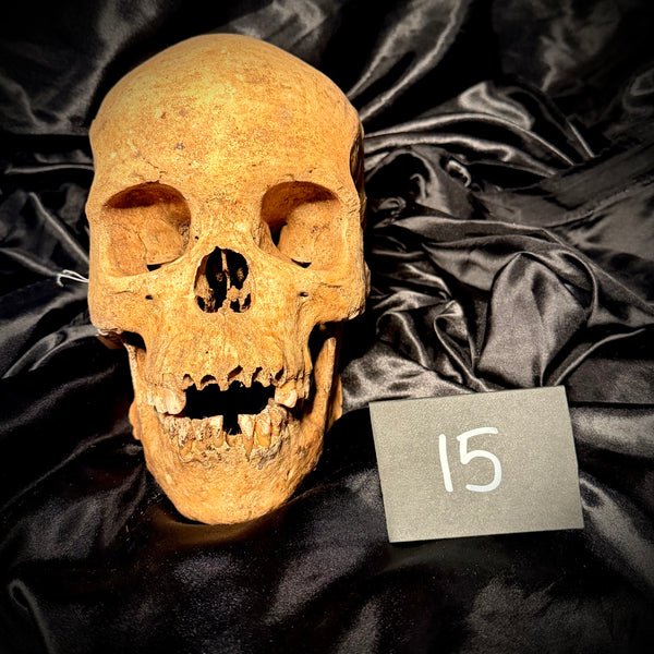 Item 15. Human skull with mandible