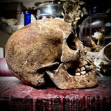 Human skull