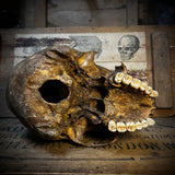 Human skull