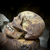 Human skull with mandible