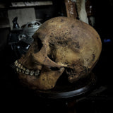 Human skull