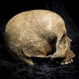 Human skull