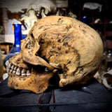 Human skull with mandible