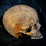 Item 9. Human skull
