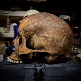 Human skull