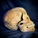 Item 1. Human skull with mandible