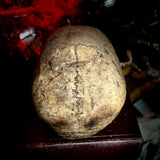 A human skull with mandible
