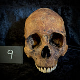 Item 9. Human skull