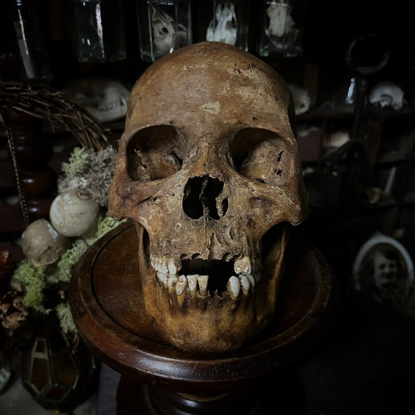 Human skull