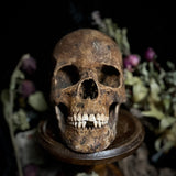 A human skull with mandible