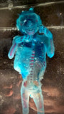 Item 1. Diaphonized human fetus