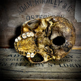 Human skull