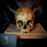 Item 3. Child skull