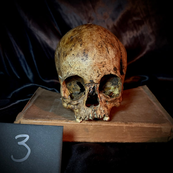 Item 3. Child skull