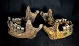 Item 9. Two human mandibles
