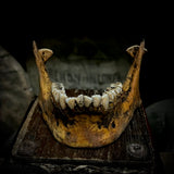 A mandible