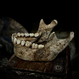 A mandible